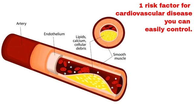 The Role of Atorvastatin in Preventing Cardiovascular Disease